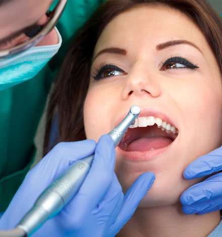 tratamientos Estética dental zaragoza