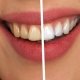 como blanquear dientes forma eficaz