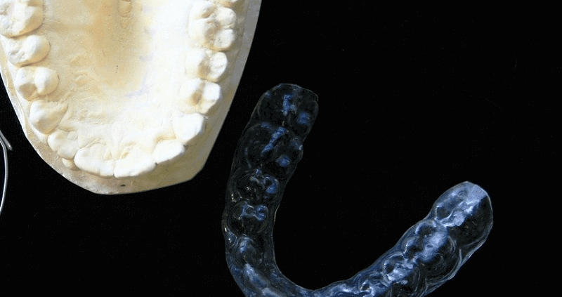 Cómo Limpiar las Férulas Dentales - Odontoclínic