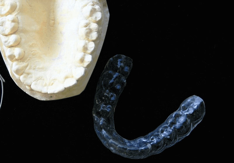 Limpieza e Higiene de una Férula Dental - clinicadentalferrergarcia