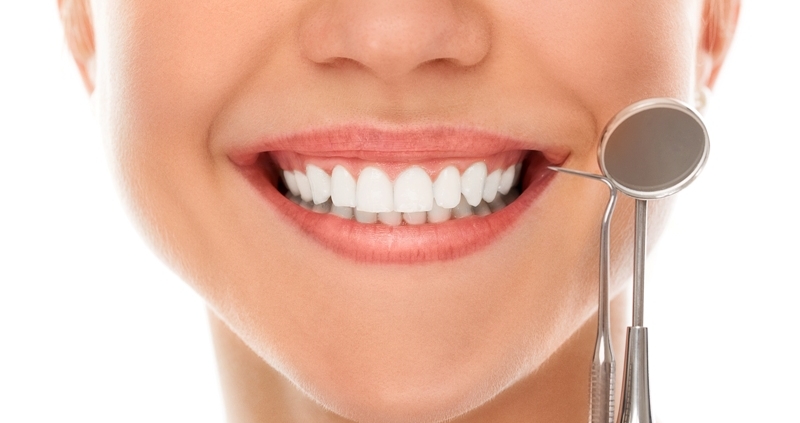 tratamientos estetica dental