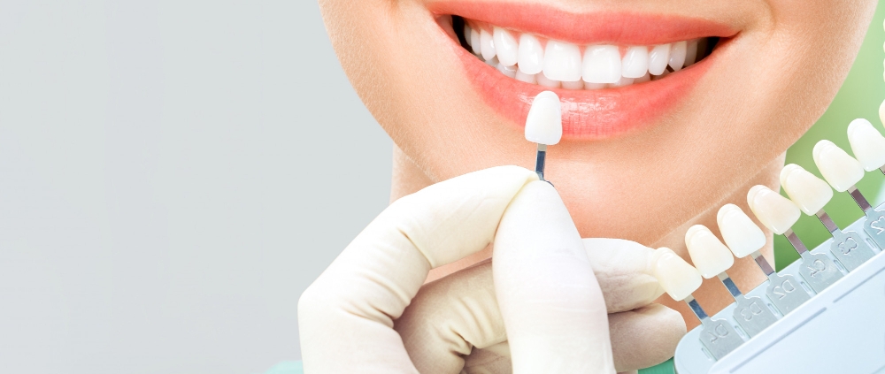 tratamientos-esteticos-dentales